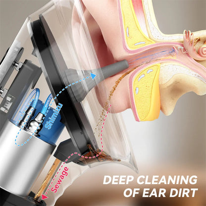 Ear Cleaning Tool with Irrigation Flusher