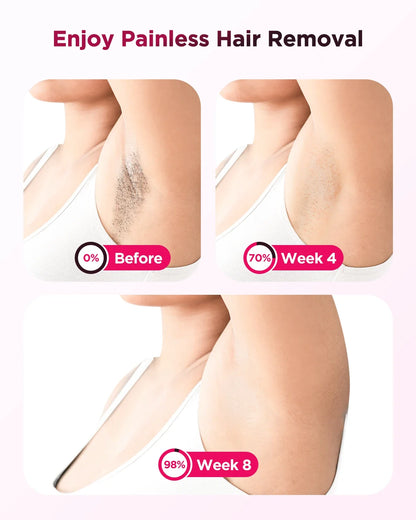 Body Bikini Facial  Permanant Painless IPL Laser  Hair Remover Machine